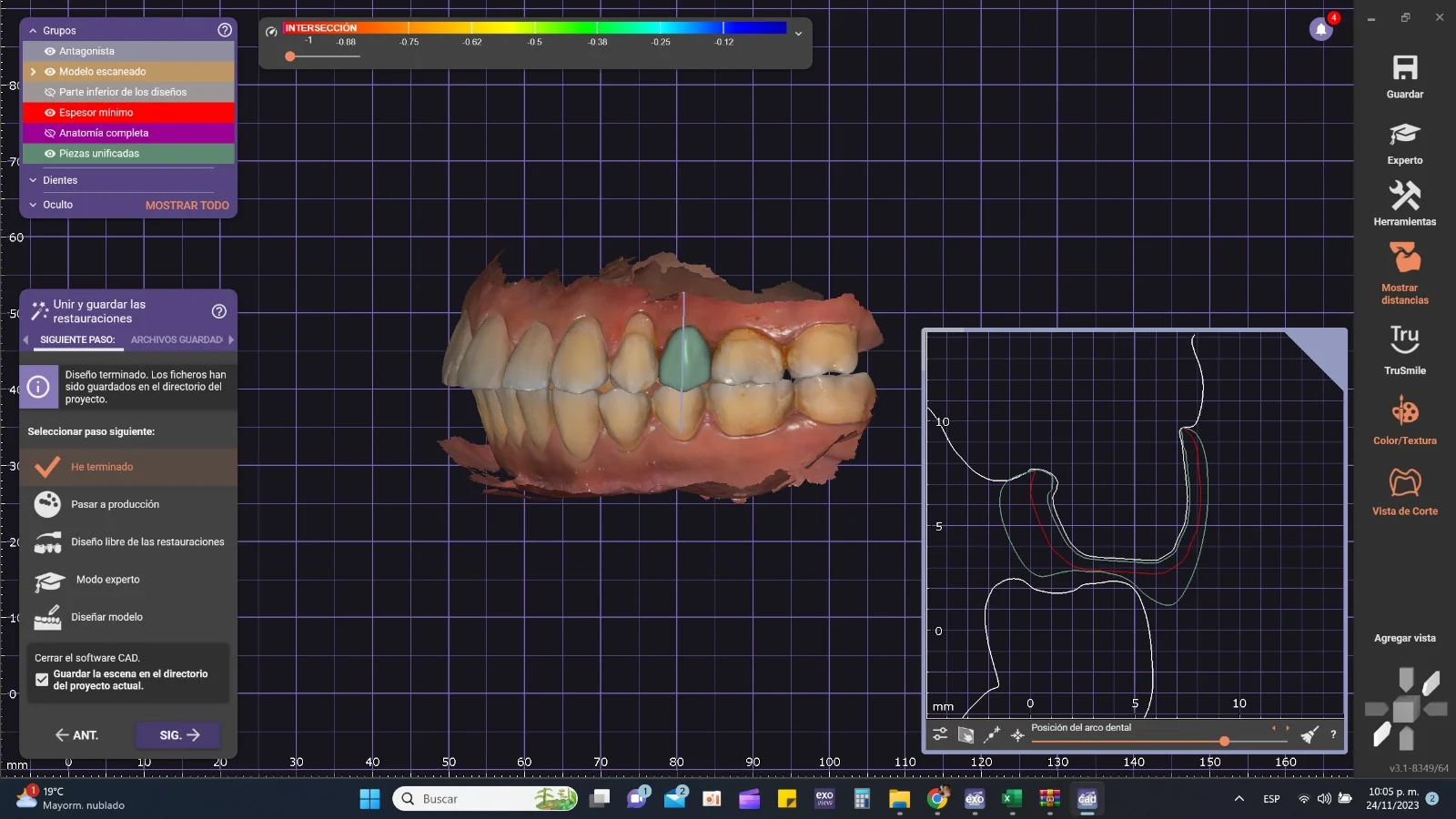 Escáner intraoral 3D