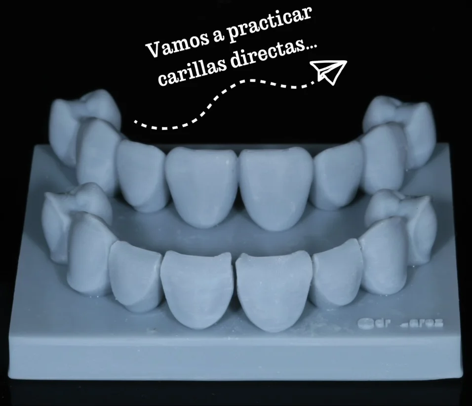 Diseño de sonrisa paso 1