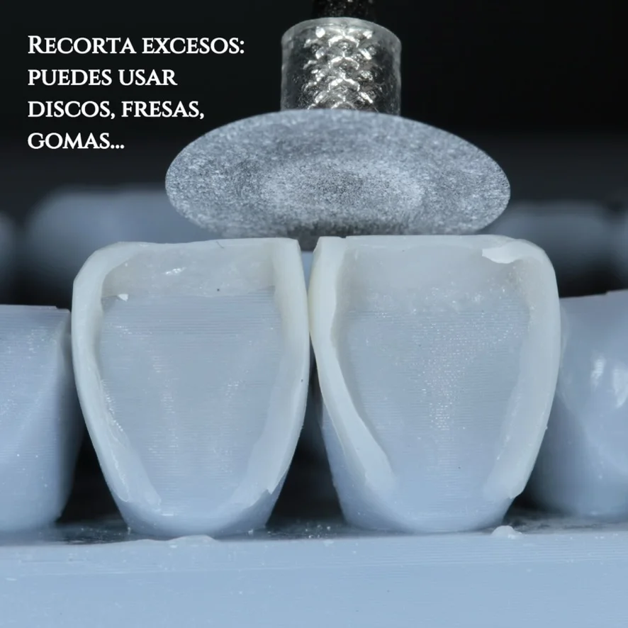 Diseño de sonrisa paso 10