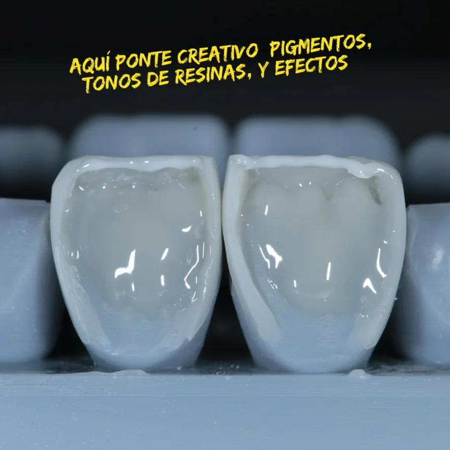 Diseño de sonrisa paso 11