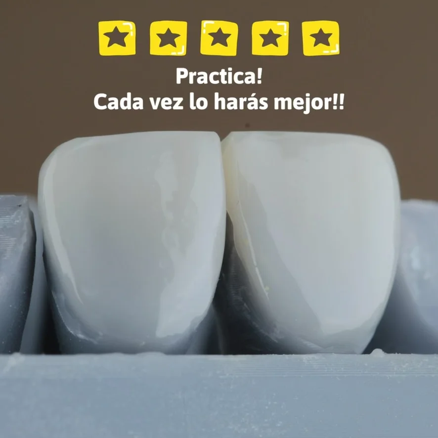 Diseño de sonrisa paso 17