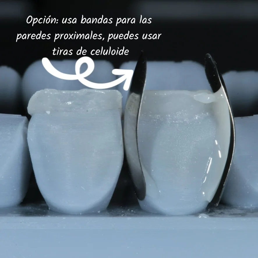 Diseño de sonrisa paso 7