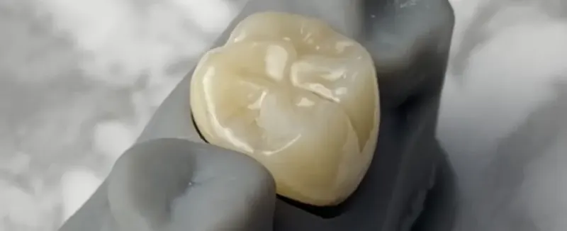 Coronas de Zirconia