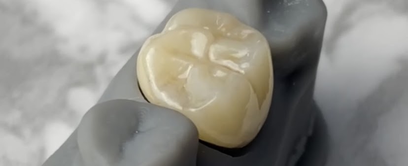 Endodoncia
