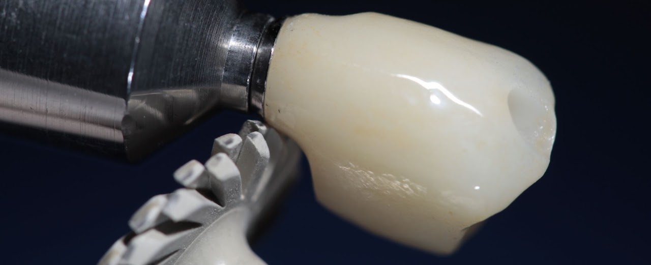 Endodoncia