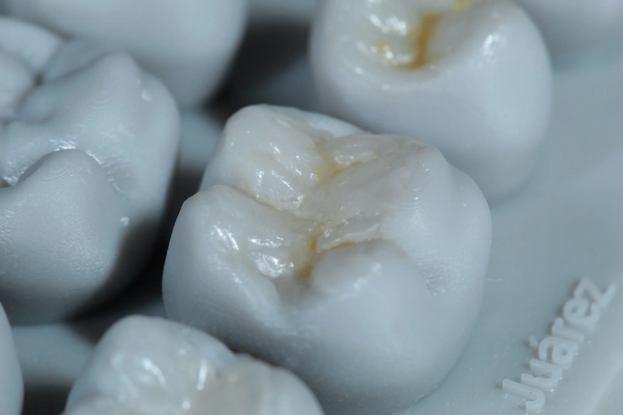 Modelado con resina dental - Dentista Veracruz