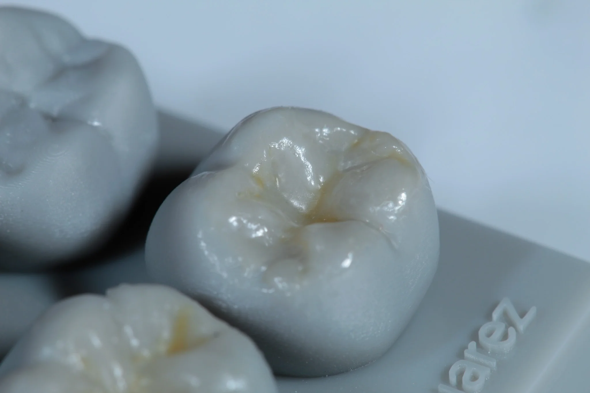 Modelado con resina dental - Dentista Veracruz