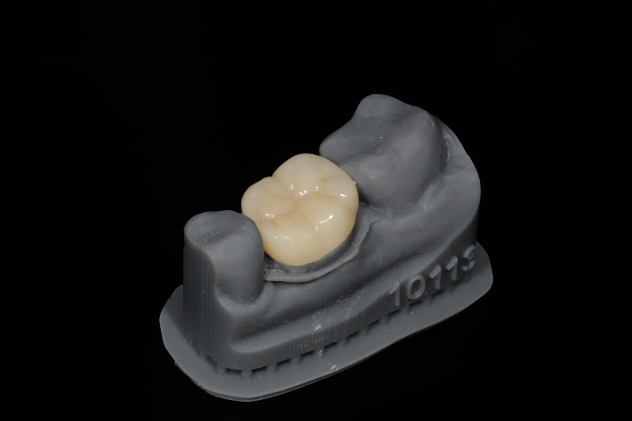 Rehabilitación con zirconia: resultado natural